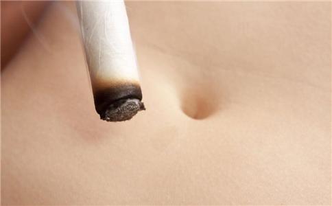 艾灸容易烫伤皮肤吗 艾灸要哪些穴位 艾灸要注意什么