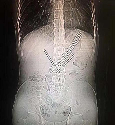 Img482015237 Img482015237