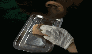 专家揭整容乱象：学员拿鸡腿练手培训三天上岗