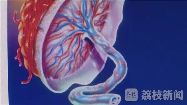 产妇发现胎盘被医院清洁工偷回家炖汤 家属真怒了