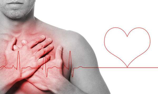 C20170412003-zx6 C20170412003-zx6