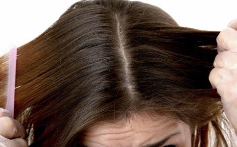 头皮屑多怎么办 头皮屑很多的原因 头皮屑很多吃什么