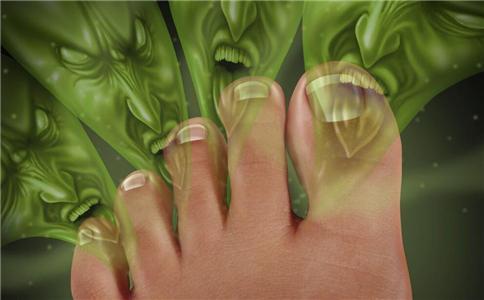 脚气总是不好怎么办 中医8个偏方治脚气 脚气怎么根治 怎么可以治疗脚气 引起脚气的原因是什么