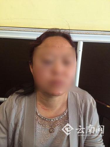 昆明一小区因停车堵消防通道连打两架 女司机称遭到6人围殴 昆明一小区因停车堵消防通道连打两架 女司机称遭到6人围殴