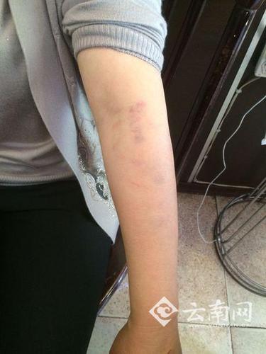 昆明一小区因停车堵消防通道连打两架 女司机称遭到6人围殴 昆明一小区因停车堵消防通道连打两架 女司机称遭到6人围殴