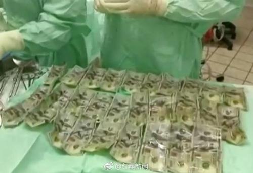 女子不愿和前男友分财产 将7000美元纸钞吞进肚子