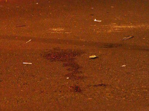 25岁孕妇遇车祸不治 医生剖腹取出6个月大女婴