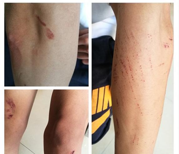 情侣校园搂抱被殴 网友：大学恋爱都不准谈了？