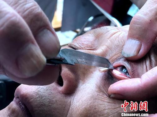 惊险又刺激的“刀锋洗眼”。　吕杨 摄