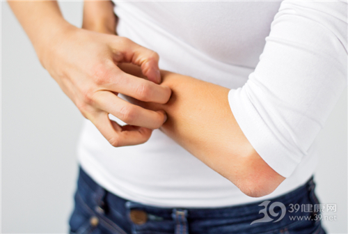 青年 女 抓痒 过敏 皮肤 手臂_26252239_xxl