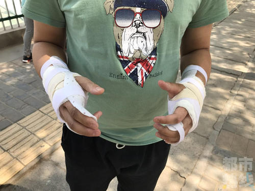 铜川16岁男生遭暴打掌骨骨折 疑因看别人接吻