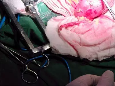 网传广西一家四口被人入室麻醉后偷走肾 警察辟谣