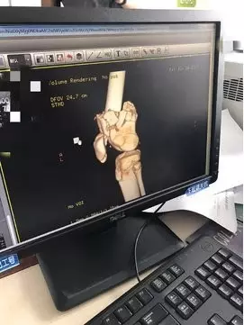 13岁男孩玩网游被骂而跳楼 刚苏醒:我要登录账号