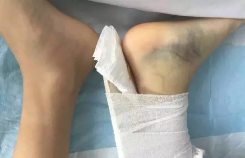 13岁男孩玩网游被骂而跳楼 刚苏醒:我要登录账号