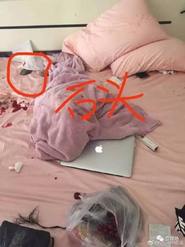 女子投诉快递员遭强行入室毒打 快递公司久不回应