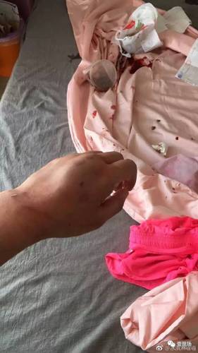 女子投诉快递员遭强行入室毒打 快递公司久不回应