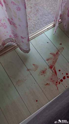 女子投诉快递员遭强行入室毒打 快递公司久不回应