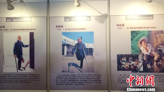 日军在浙细菌战受害幸存者的照片、悲惨遭遇口述 张煜欢 摄