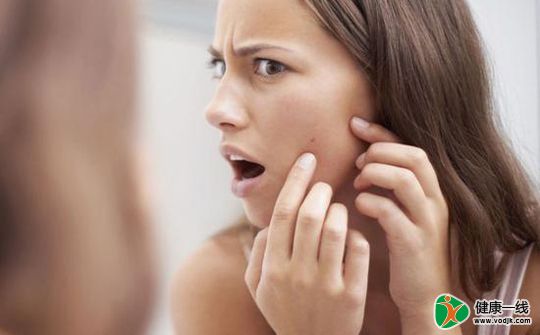 爱长痘？ 多吃4种食物