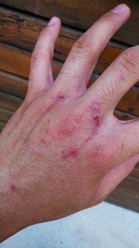 点击进入下一页