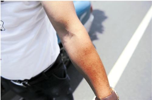 胳膊上的阴阳面取决于太阳的照射角度。