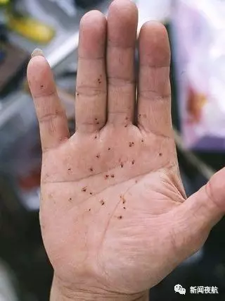 密恐慎入!哈尔滨街头漫天小飞虫 专家:别穿黄衣服