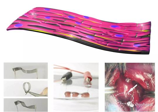 中国学者研发创新性“补心”构想新型补片将造?；颊? style=