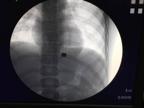 点击进入下一页