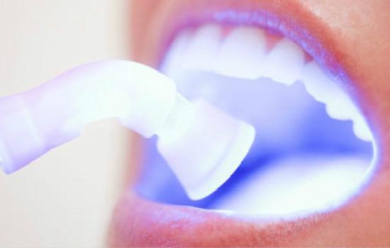 牙齿冷光美白安全吗?看看专家咋说