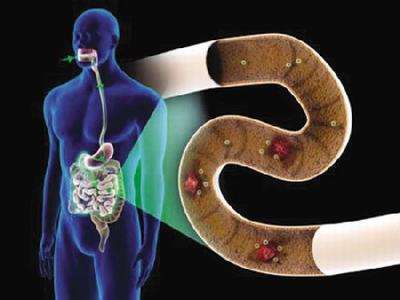 11岁女孩每天至少吃两包辣条 患罕见克罗恩病