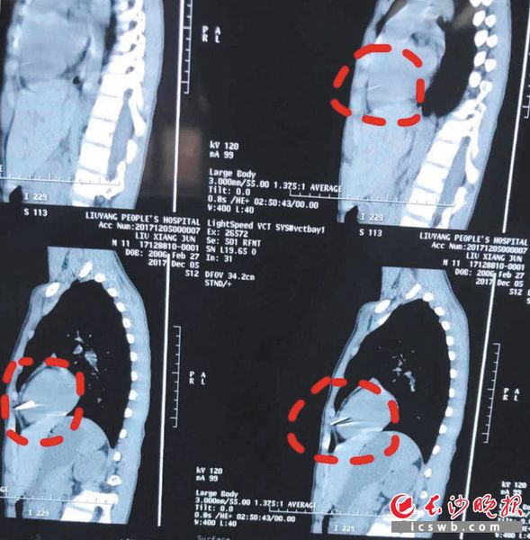 MAIN201712070849000447513051010 MAIN201712070849000447513051010