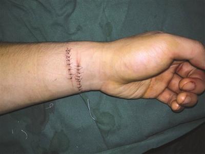 点击进入下一页