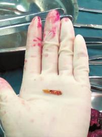 这个新年，来自双阳的李先生一家在胆战心惊中度过……