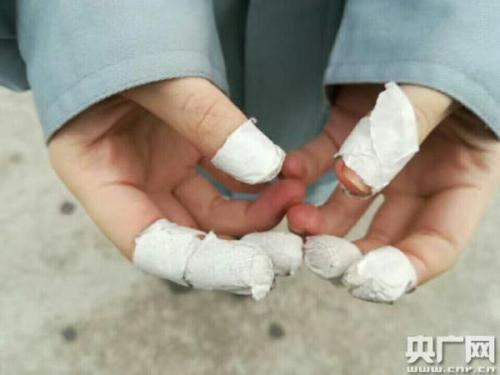 聊城大学安全工程专业一位学生在昆山康佳电子有限公司实习后展示双手  点击进入下一页