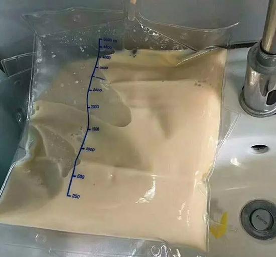 一日三餐全靠外卖 血浆变成猪油色?