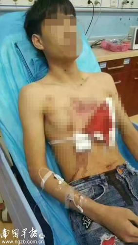 一伙蒙面男冲向超市持枪乱射致5人受伤 法院这样判