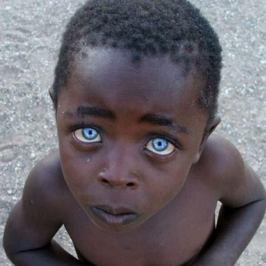 人体基因突变 你见过这样的奇人吗？