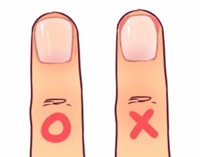 4、注意手指的保养。平时多涂点护手霜，可增加甲沟周围皮肤的抗病能力；