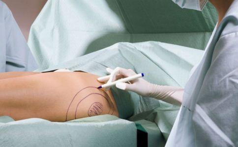 腿部吸脂分几个部位 吸对才能快速瘦 腿部吸脂分几个部位 腿部吸脂的方法有哪些 腿部吸脂有哪些优势