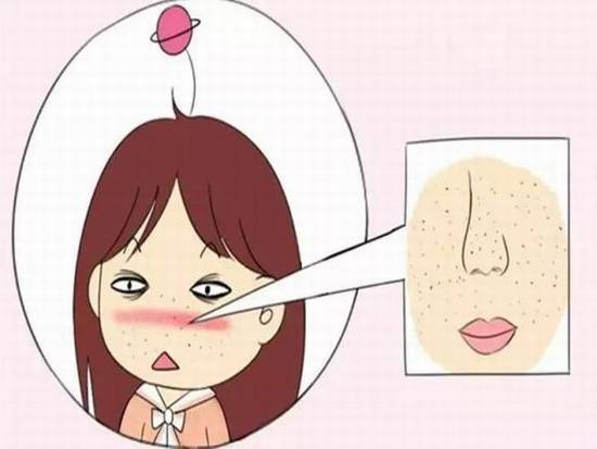 怎么才能告别“草莓鼻”变回小仙女?