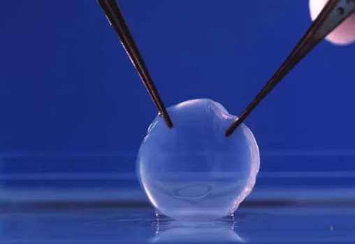 视力突然下降 为什么要移植角膜?