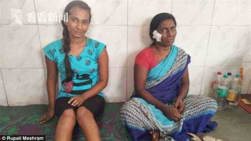 印度女子持棍棒和老虎对打 满脸是血赶紧发自拍