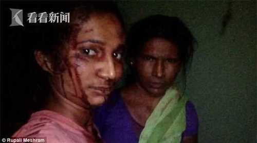 印度女子持棍棒和老虎对打 满脸是血赶紧发自拍