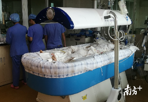 痛心!广州17岁少女洗澡时煤气爆炸 全身90%烧伤