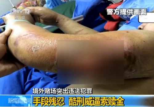 团伙诱骗中国公民偷渡出境参赌 酷刑威逼索要赎金