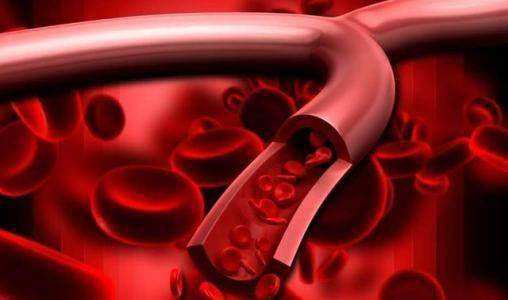 几种坏习惯最伤血管