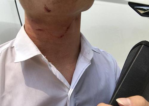 男子未给好评遭顺风车司机打:不让下车 被掐险窒息