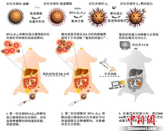中国学者有望实现精准切除腹腔恶性转移肿瘤