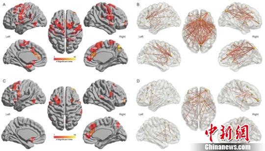 睡眠以及抑郁问题相关联脑区以及脑功能连接在脑中的分布情况?！⊙芯客急?摄