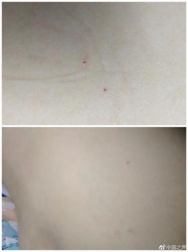 点击进入下一页